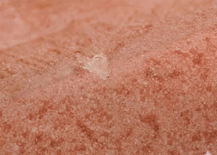 Granit Tamiri Öncesi